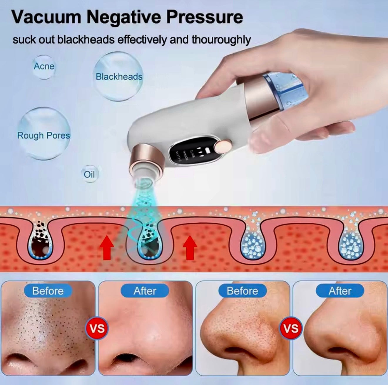 PoreErase™ Vacuum